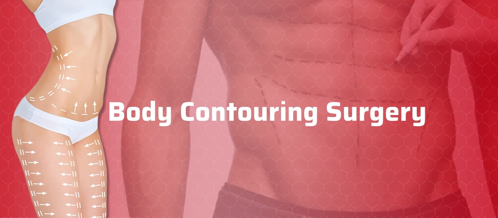 Body Contouring Surgery