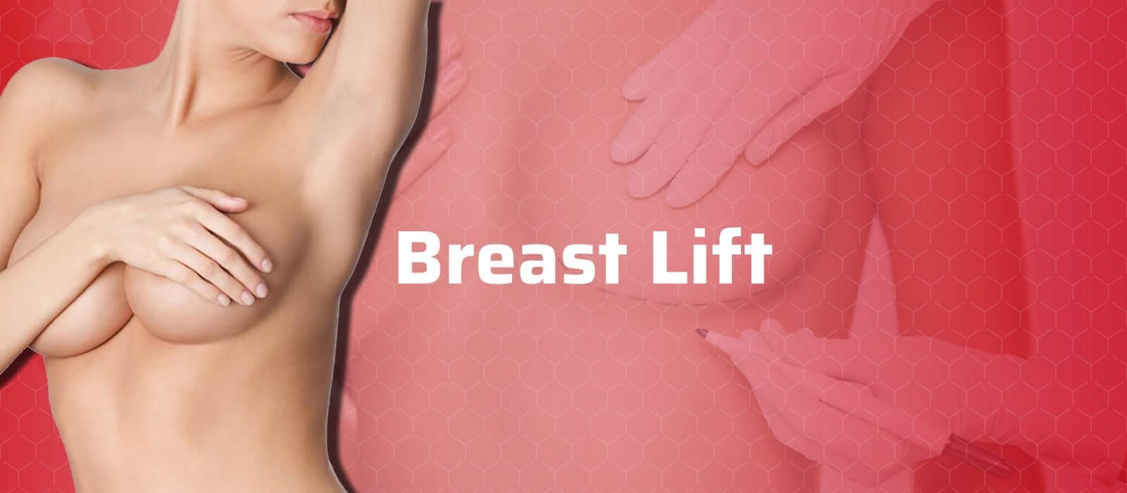 Breast Lift