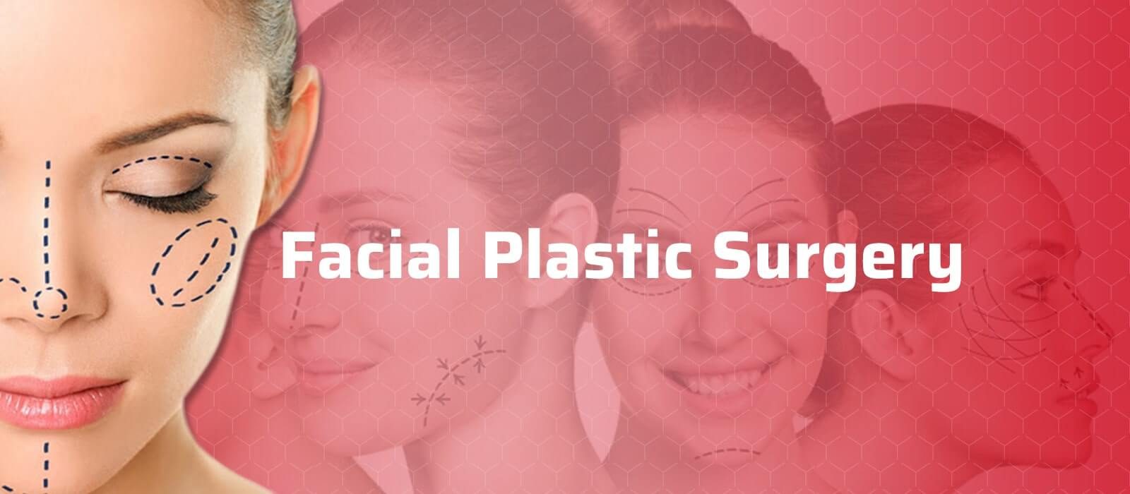 Facial Plastic Surgery