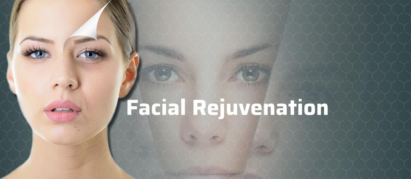 Facial Rejuvenation