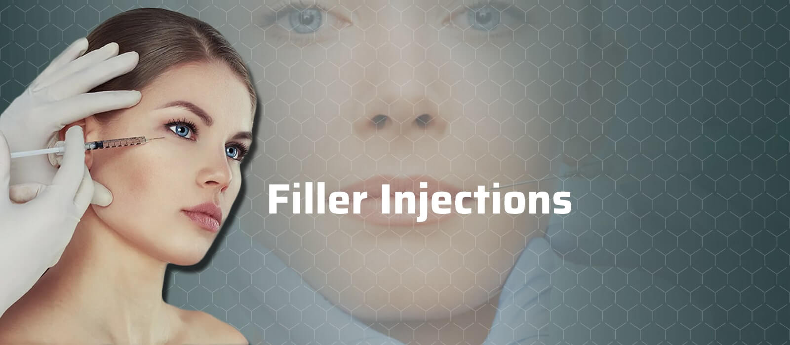Filler Injections