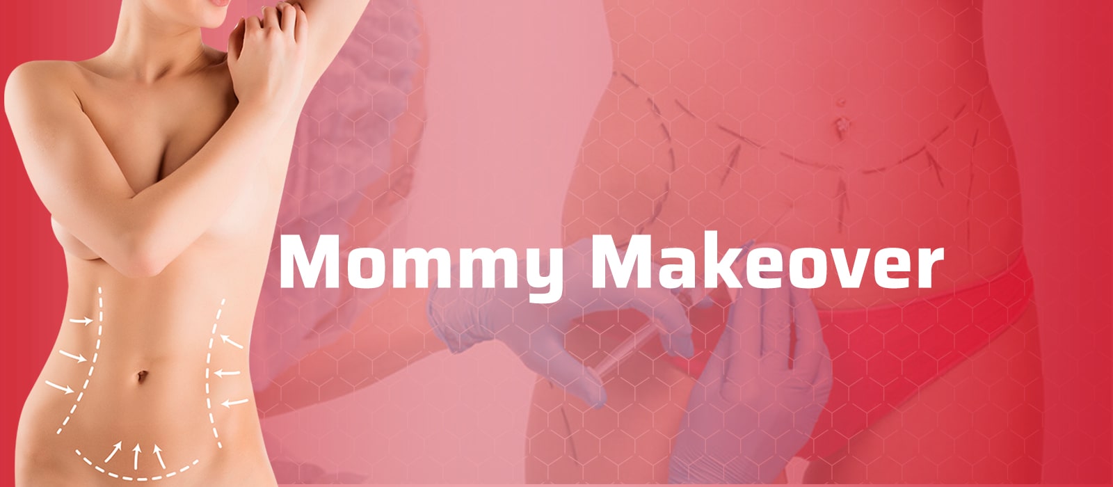Mommy Makeover