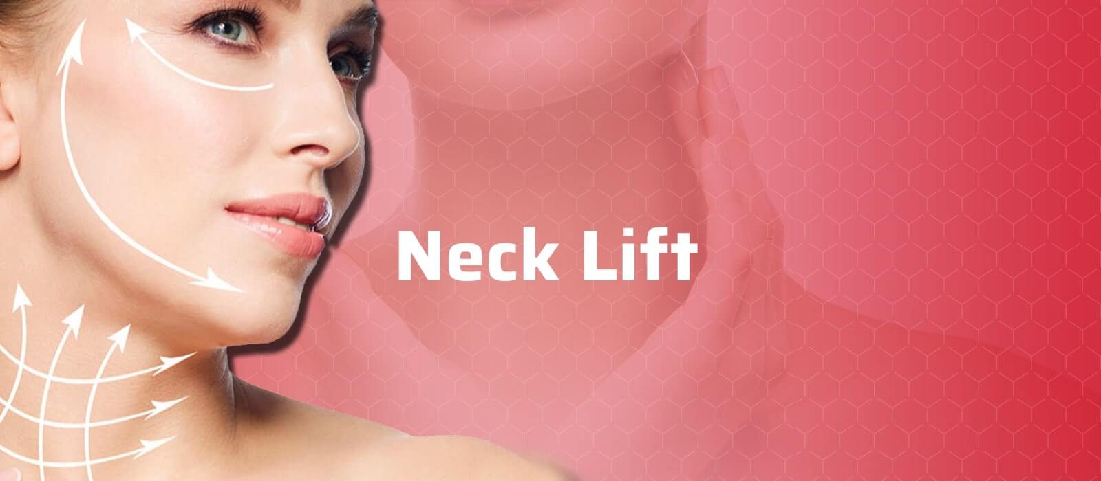 Neck Lift