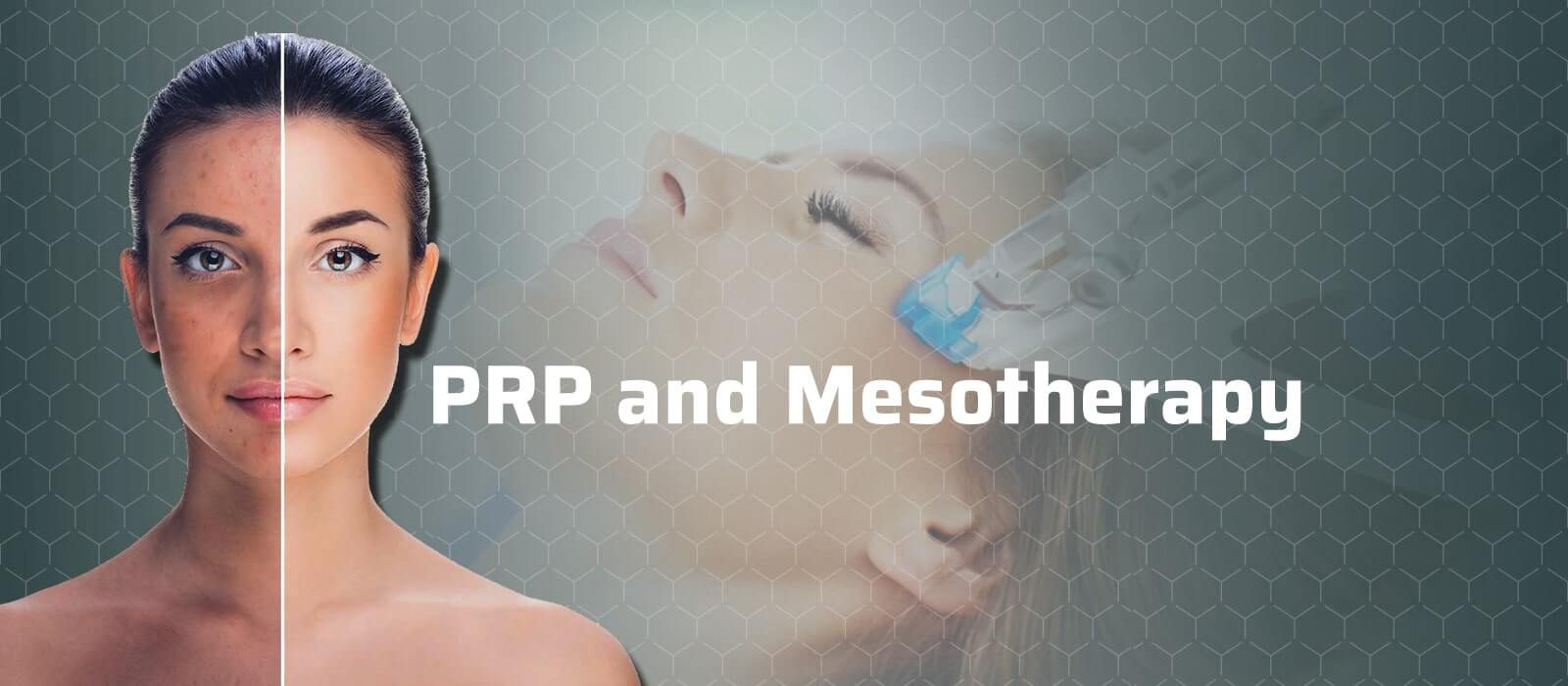 PRP And Mesotherapy