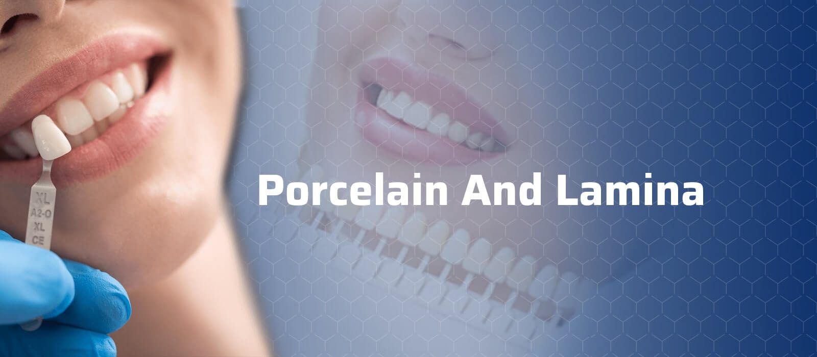 Porcelain And Lamina