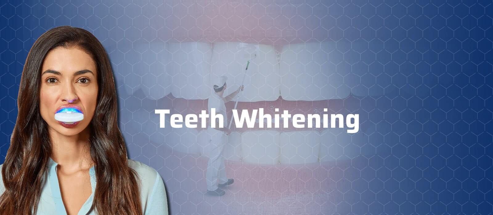 Teeth Whitening In Turkey