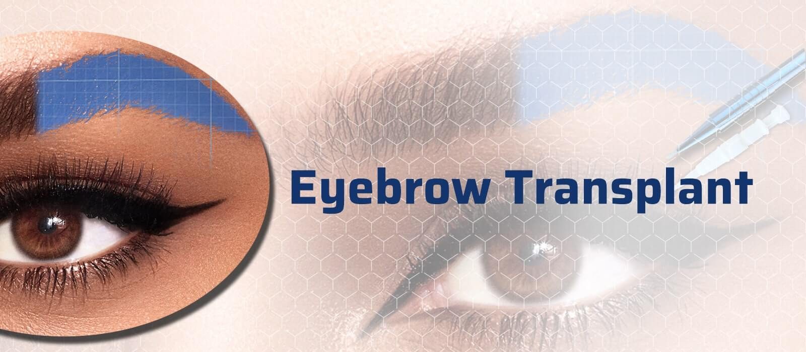 Eyebrow Transplant Procedure