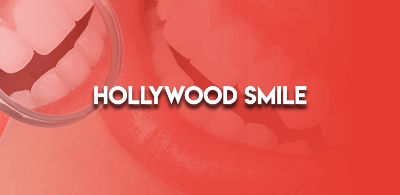 Hollywood Smile